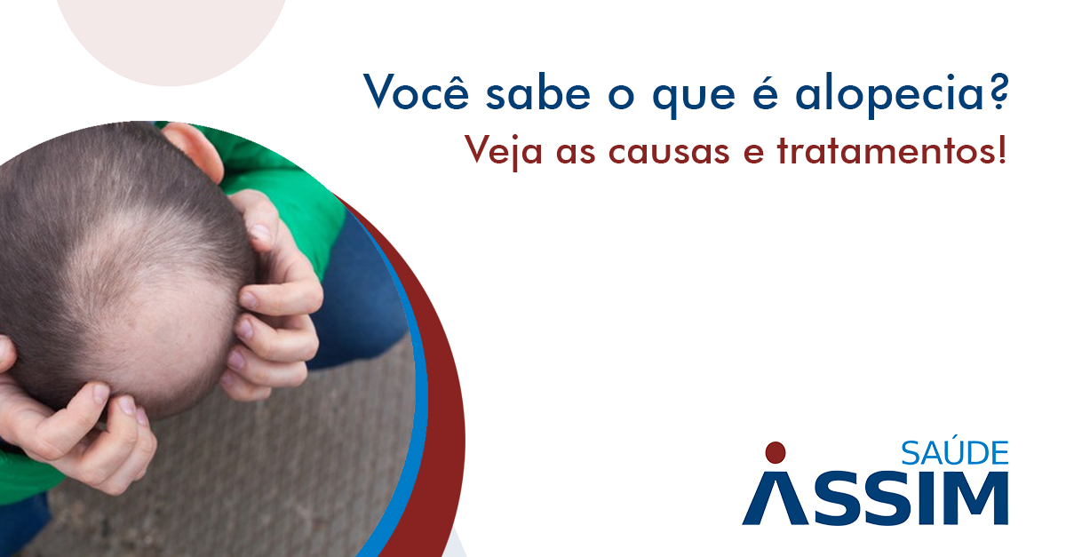 Voc� sabe o que � alopecia? Veja as causas e tratamentos!