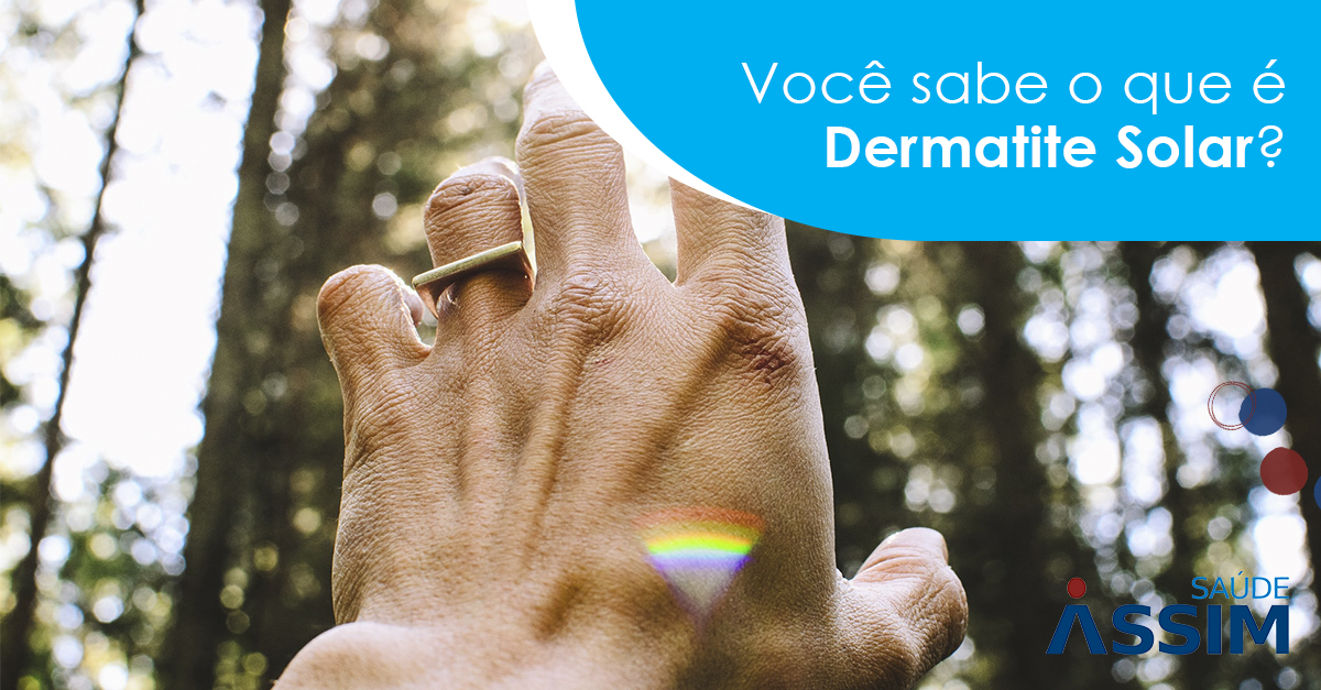 Voc� sabe o que � Dermatite Solar?
