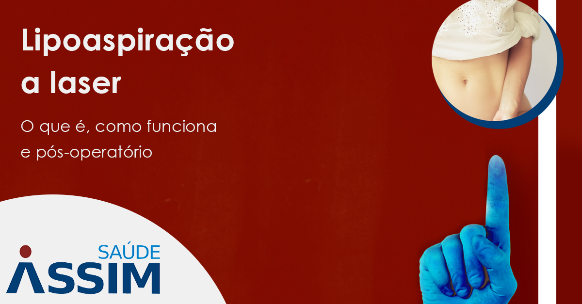 Lipoaspira��o a laser: o que �, como funciona e p�s-operat�rio